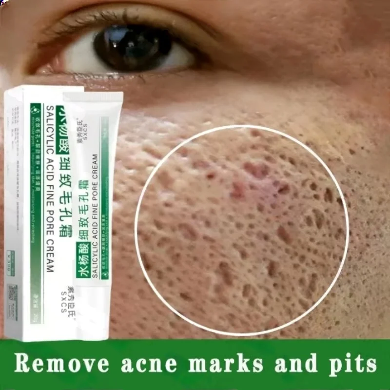 Skincare Salicylic Acid - Salicylic Acid Pore Clearing Cream รูขุมขนหดตัวลบสิวหัวดําสิว