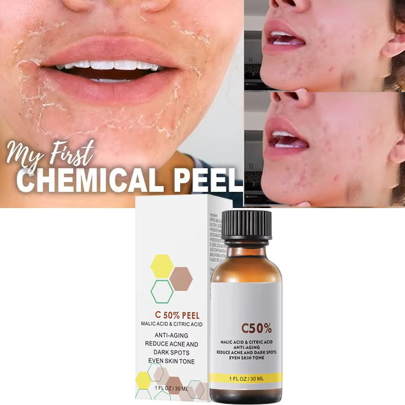 Skincare Salicylic Acid - ด้วย Malic Acid และกรดซิตริกสําหรับ Face Facial