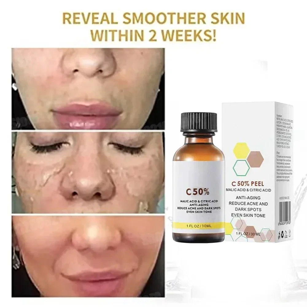 Salicylic Acid Face Facial Pee - Skincare Salicylic Acid บทวิจารณ์และราคา