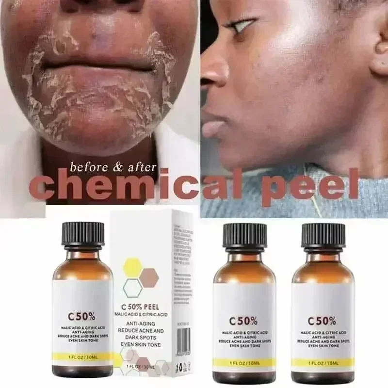 Salicylic Acid Face Facial Pee - Skincare Salicylic Acid บทวิจารณ์และราคา