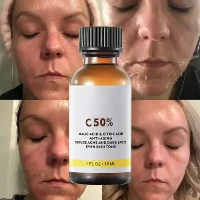 Salicylic Acid Face Facial Pee - Skincare Salicylic Acid บทวิจารณ์และราคา