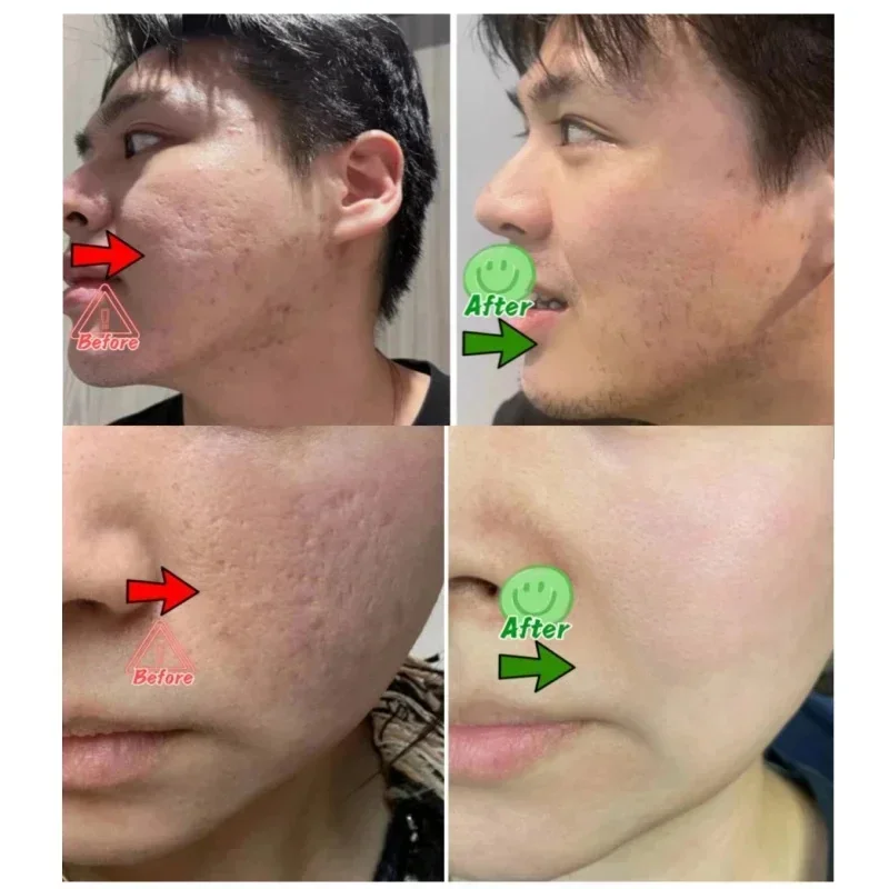 Salicylic Acid Pore Clearing C - Skincare Salicylic Acid บทวิจารณ์และราคา