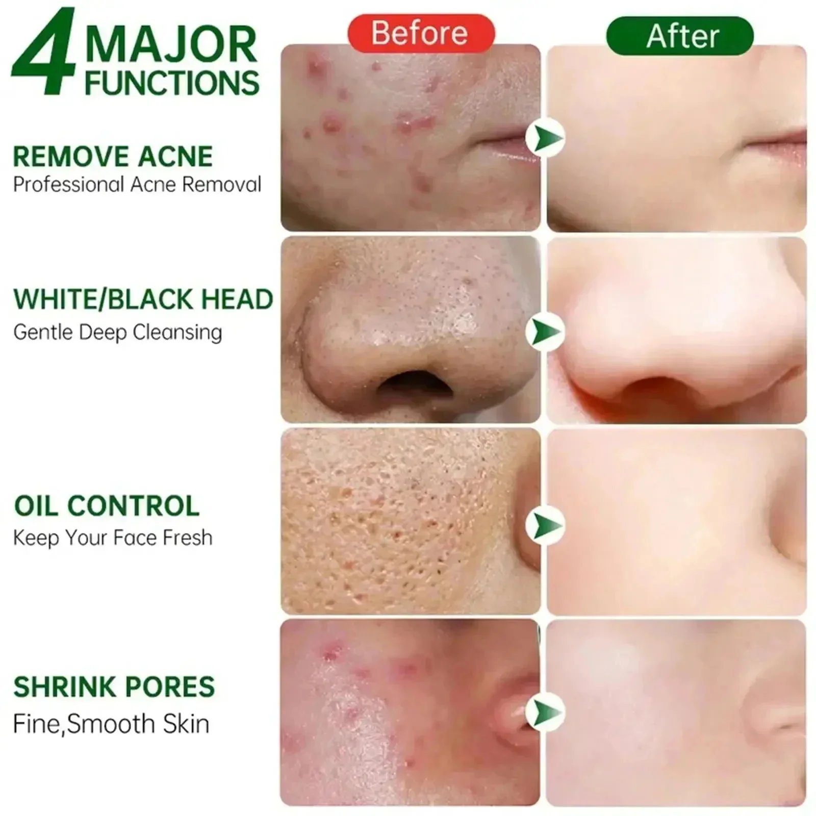 Salicylic Acid Pore Clearing C - Skincare Salicylic Acid บทวิจารณ์และราคา
