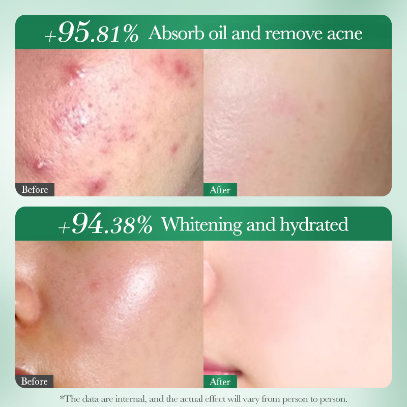 คลีนเซอร์หน้าสูตรกรดซาลิไซลิก  - Salicylic Acid Cleanser บทวิจารณ์และราคา