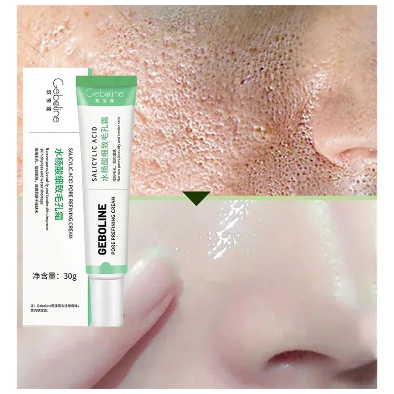 ครีมลดรูขุมขนกรดซาลิไซลิกกำจัด - Skincare Salicylic Acid บทวิจารณ์และราคา