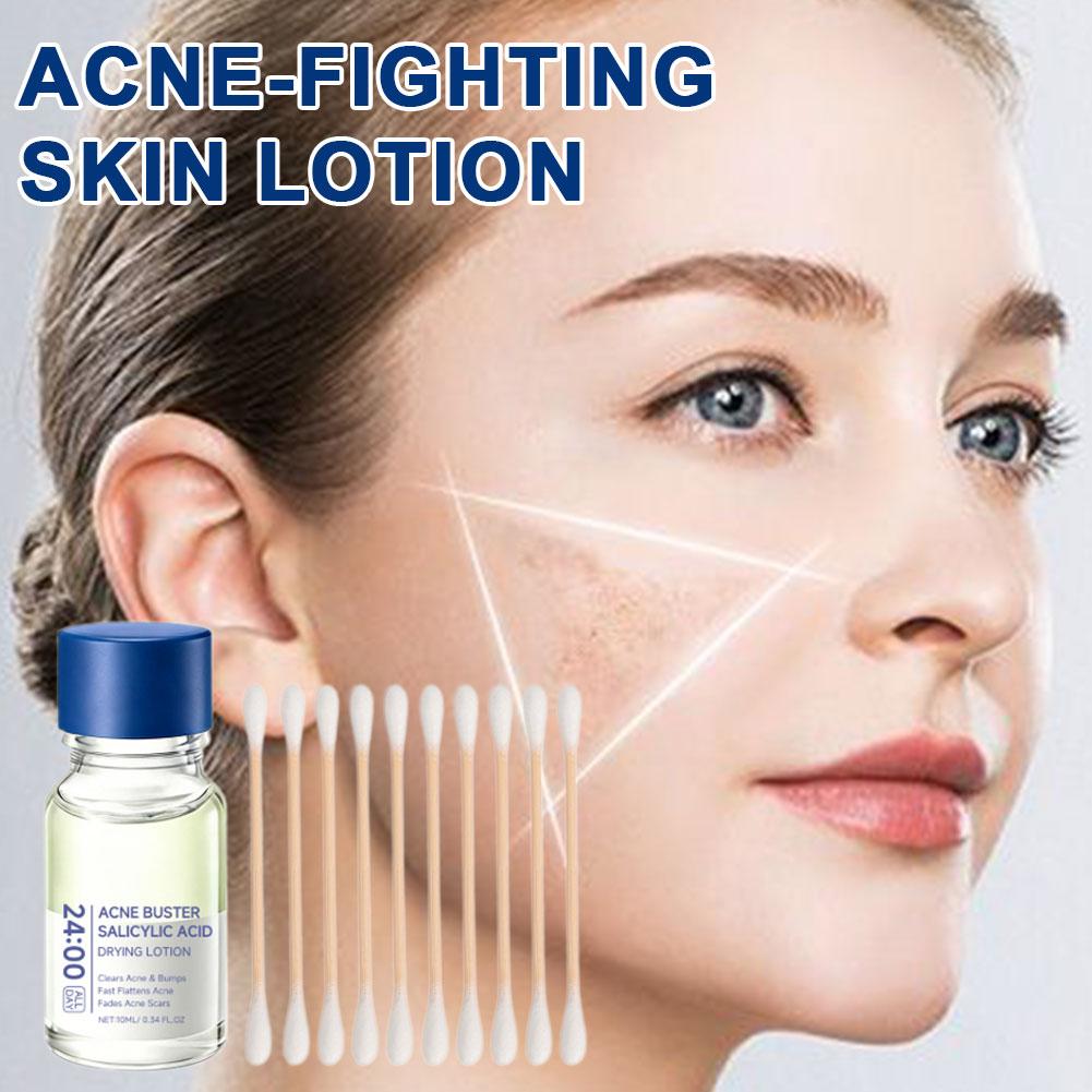 ซาลิไซลิก แอซิด เอสเซ้นส์ ทรีท - Skincare Salicylic Acid บทวิจารณ์และราคา