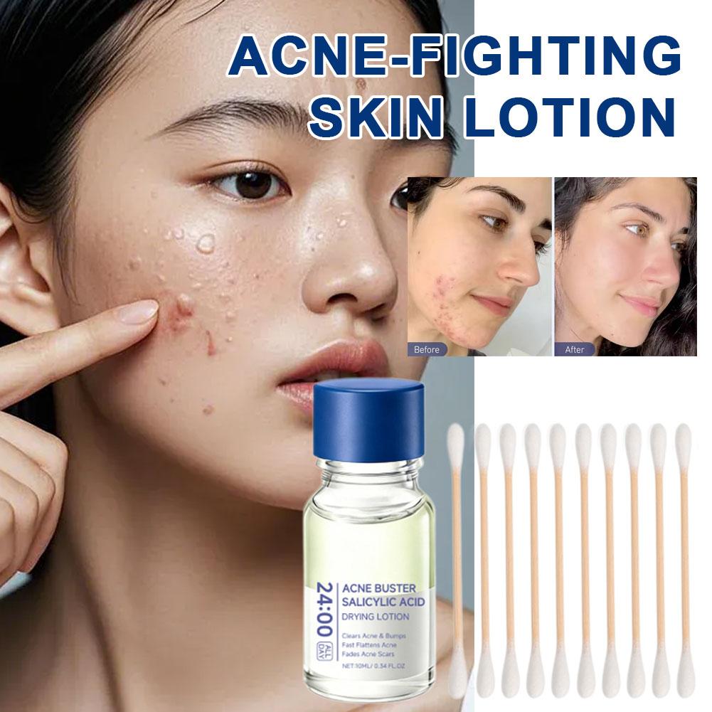 ซาลิไซลิก แอซิด เอสเซ้นส์ ทรีท - Skincare Salicylic Acid บทวิจารณ์และราคา