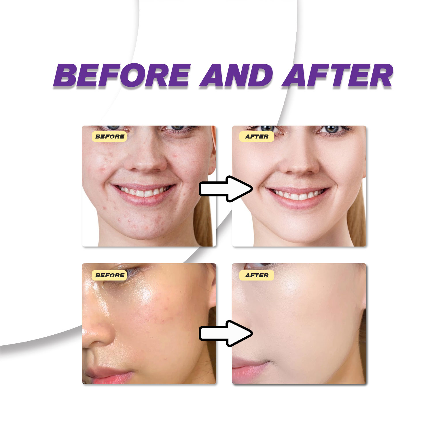 ครีมกรดอะซีเลอิกสูตรอ่อนโยน ช่ - Skincare Skintific บทวิจารณ์และราคา